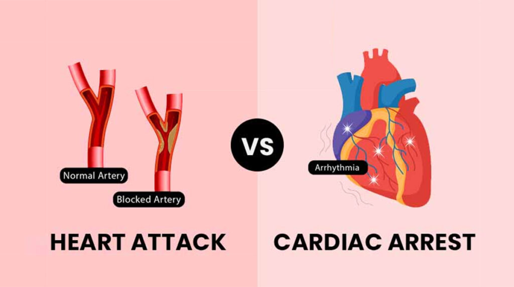 Heart Attack vs. Cardiac Arrest: What’s the Difference?