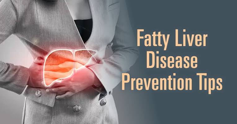 Everything You Need to Know About Fatty Liver Disease